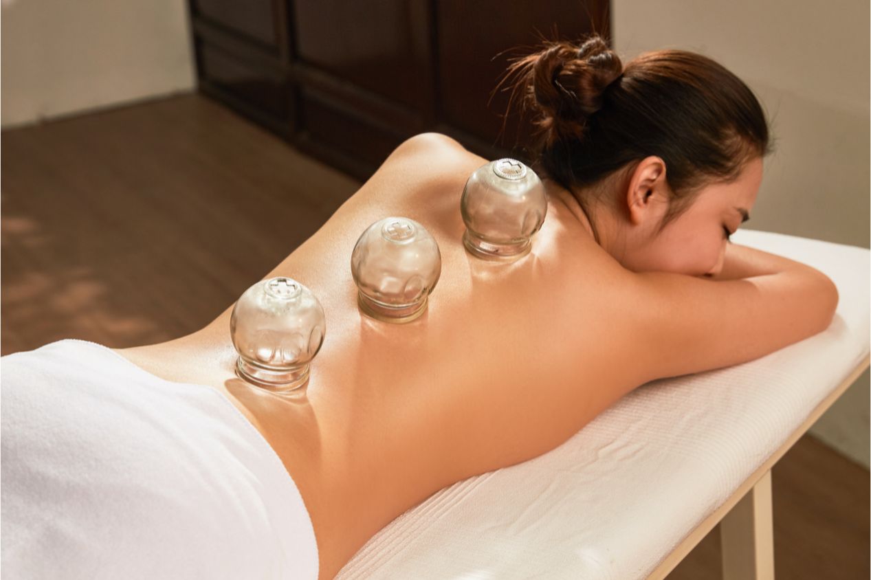 Cupping terapija