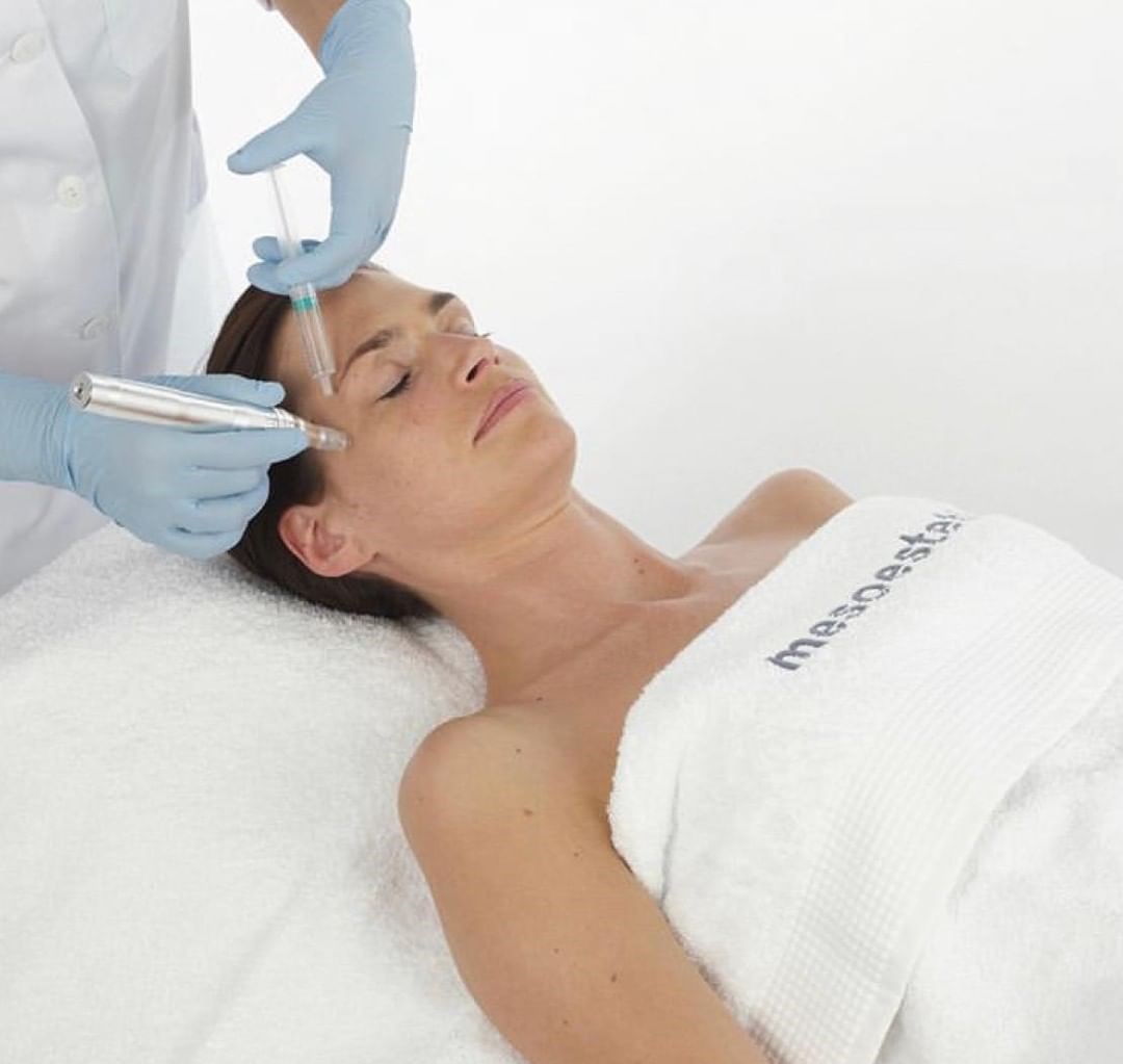 Microneedling